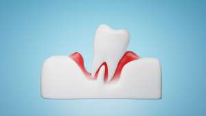 Dentist in Kamloops for gum treatment